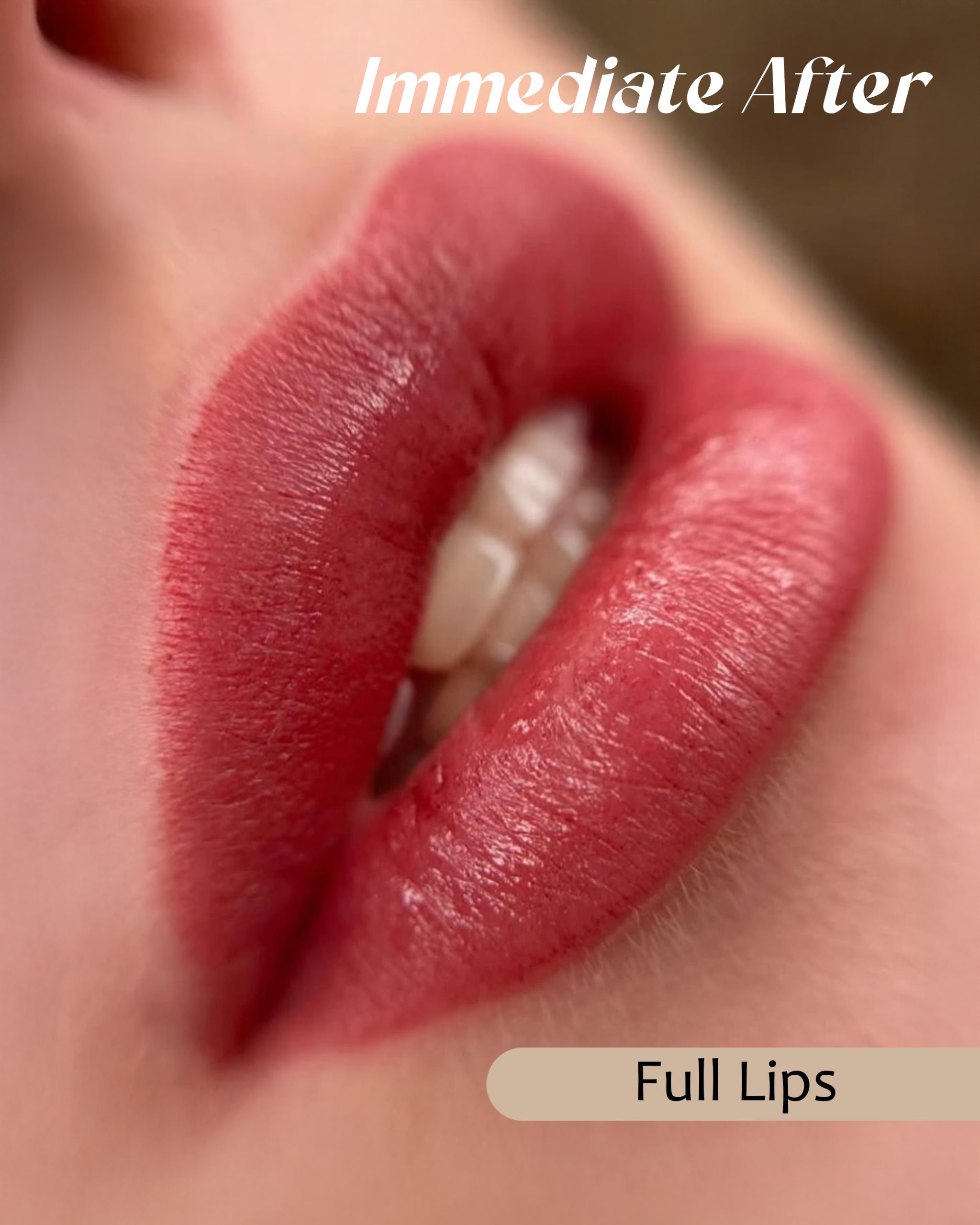 Lips _1