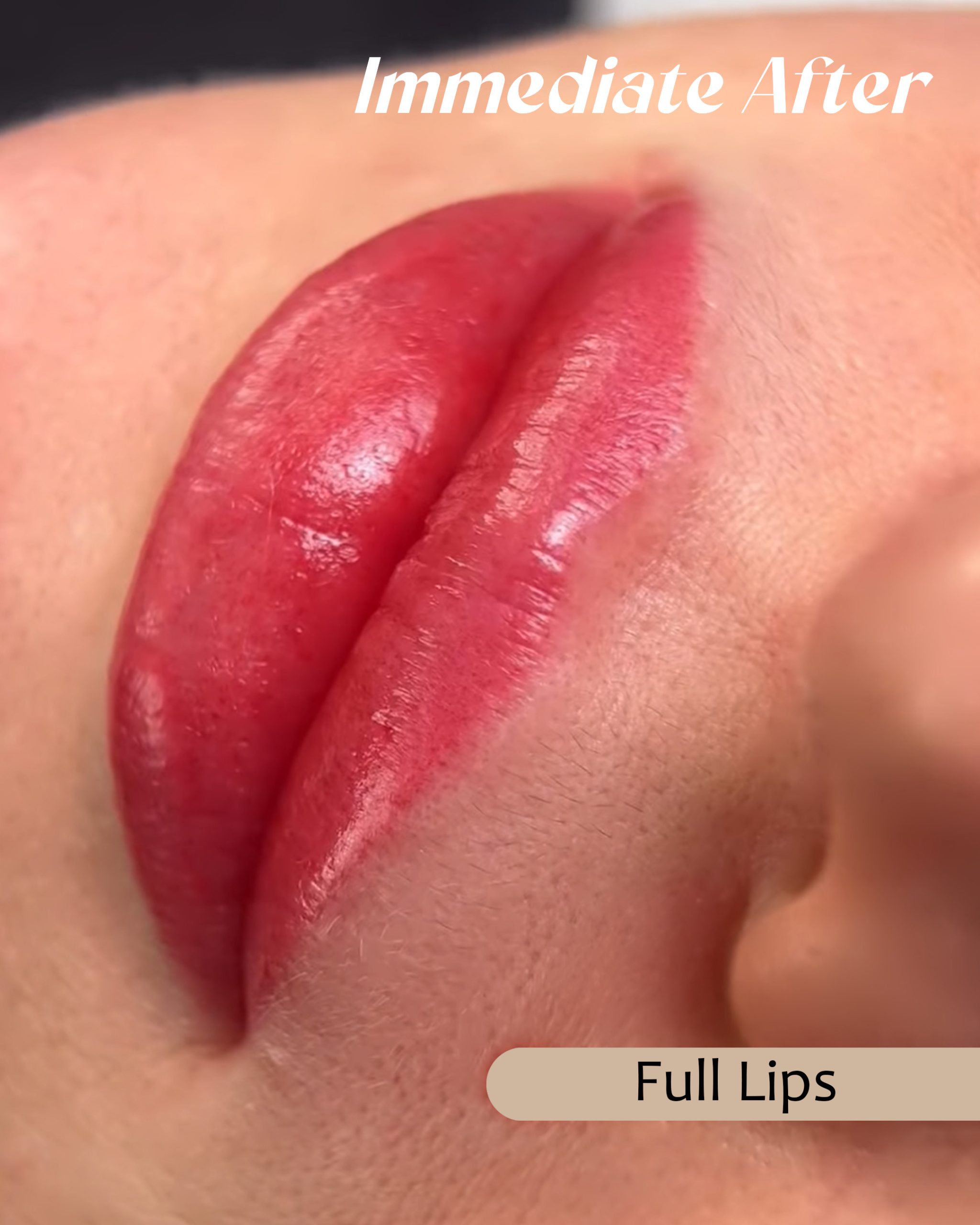 Lips _2